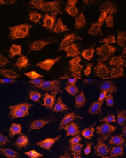 PTCD1 Rabbit Polyclonal Antibody - Image 2