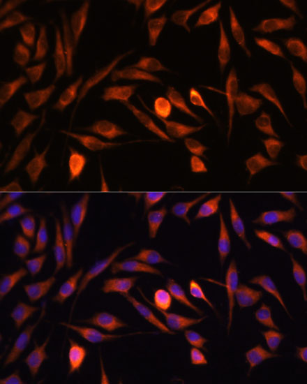 PTCD1 Rabbit Polyclonal Antibody - Image 3