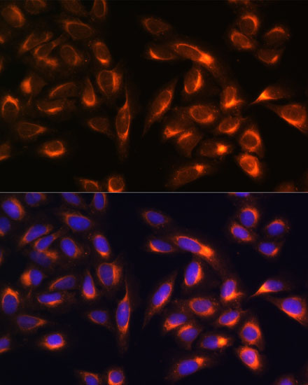 PTCD1 Rabbit Polyclonal Antibody - Image 4
