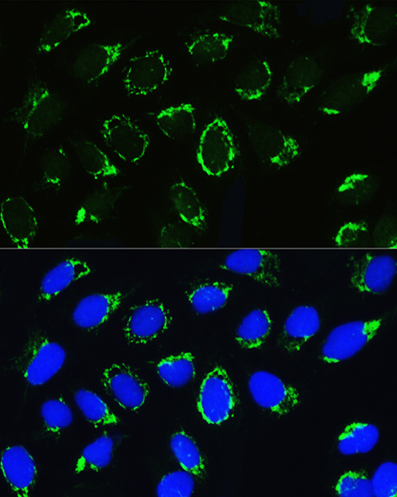 PTCD3 Rabbit Polyclonal Antibody - Image 2