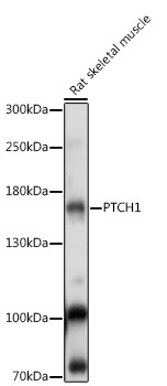PTCH1 Rabbit Polyclonal Antibody