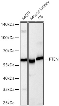 PTEN Rabbit Monoclonal Antibody