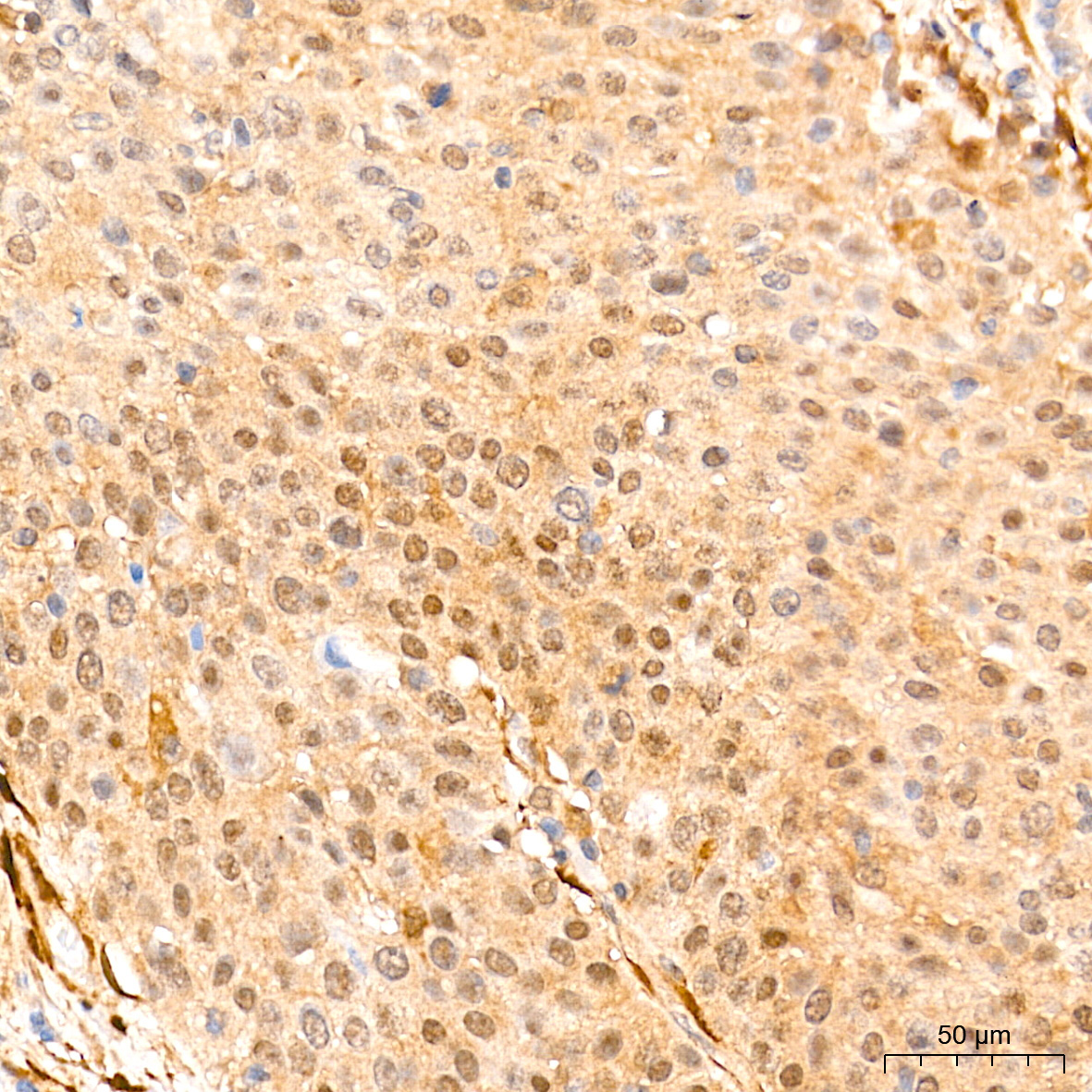 PTEN Rabbit Monoclonal Antibody - Image 2