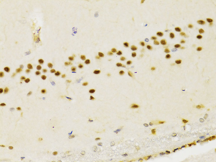 PTEN Rabbit Polyclonal Antibody