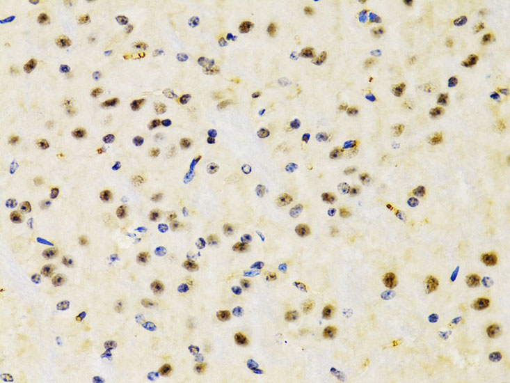 PTEN Rabbit Polyclonal Antibody - Image 2