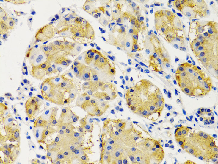 PTEN Rabbit Polyclonal Antibody - Image 3