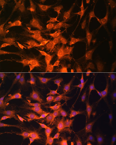PTEN Rabbit Polyclonal Antibody - Image 4
