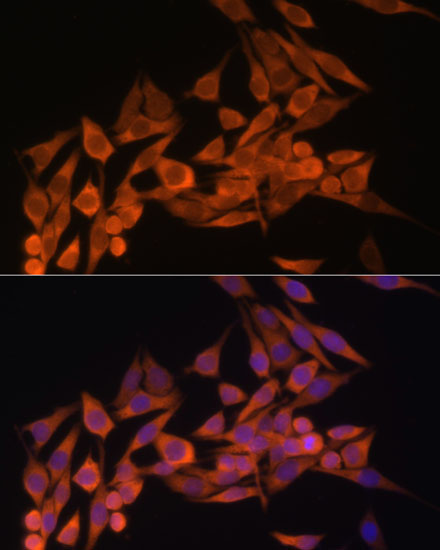 PTEN Rabbit Polyclonal Antibody - Image 5