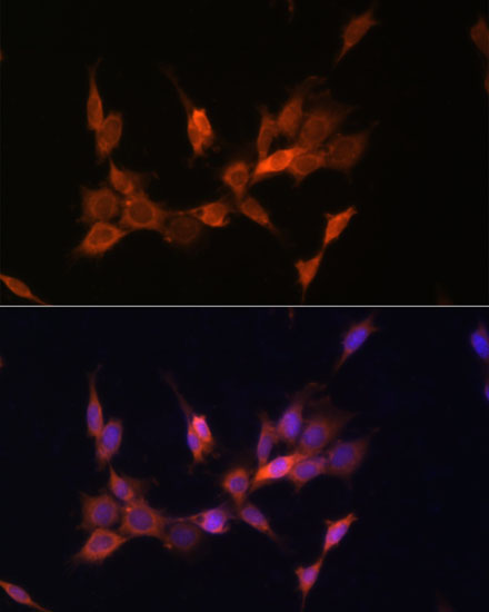 PTEN Rabbit Polyclonal Antibody - Image 6
