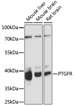 PTGFR Rabbit Polyclonal Antibody