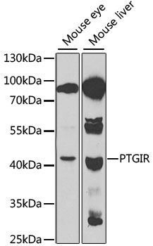 PTGIR Rabbit Polyclonal Antibody