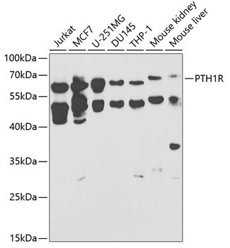 PTH1R Rabbit Polyclonal Antibody