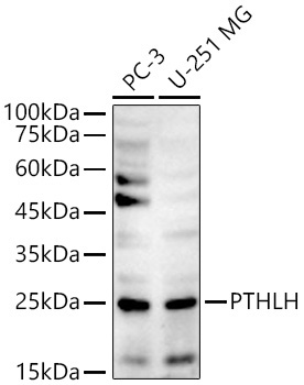 PTHLH Rabbit Polyclonal Antibody