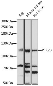 PTK2B Rabbit Polyclonal Antibody