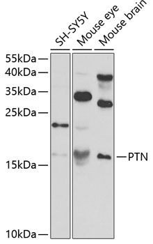 PTN Rabbit Polyclonal Antibody