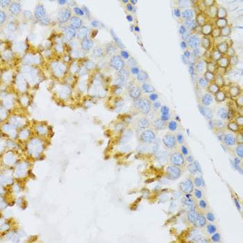 PTN Rabbit Polyclonal Antibody - Image 2