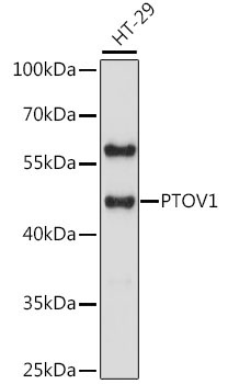 PTOV1 Rabbit Polyclonal Antibody