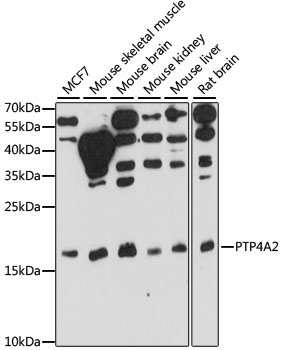 PTP4A2 Rabbit Polyclonal Antibody