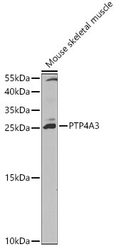 PTP4A3 Rabbit Polyclonal Antibody