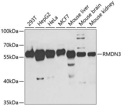 PTPIP51/RMDN3 Rabbit Polyclonal Antibody