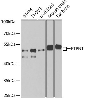 PTPN1 Rabbit Polyclonal Antibody
