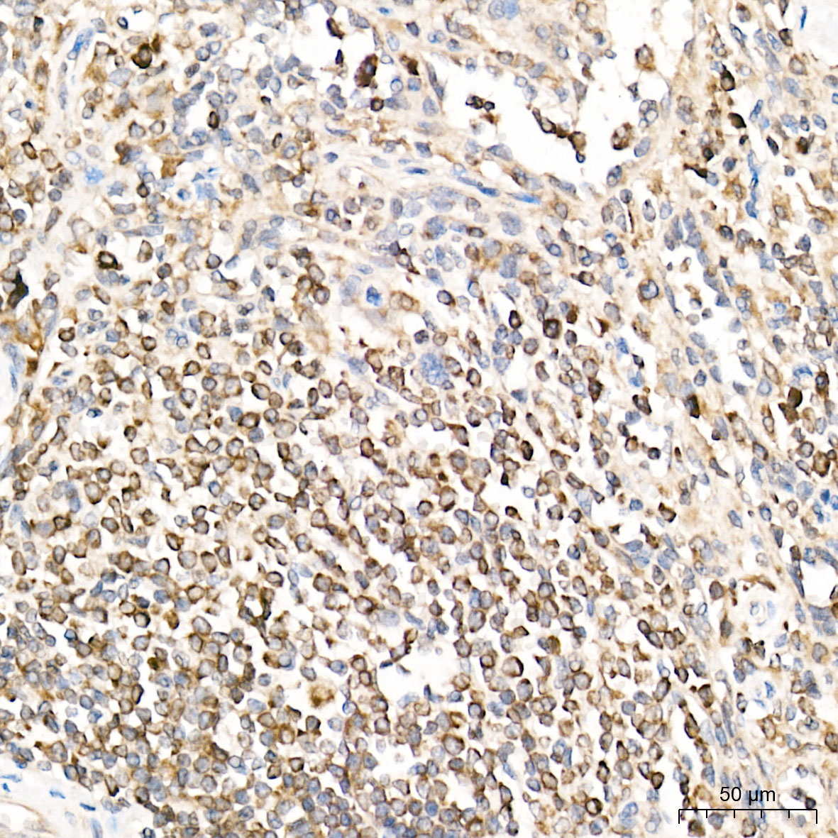 PTPN1 Rabbit Polyclonal Antibody - Image 2