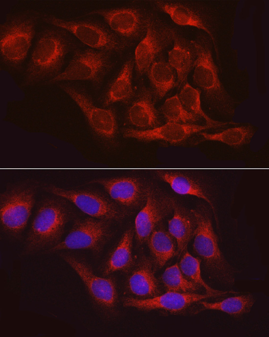 PTPN1 Rabbit Polyclonal Antibody - Image 3