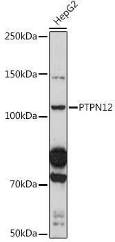PTPN12 Rabbit Polyclonal Antibody