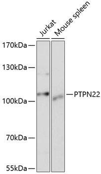 PTPN22 Rabbit Polyclonal Antibody