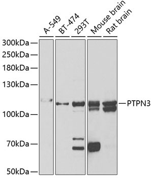 PTPN3 Rabbit Polyclonal Antibody