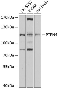 PTPN4 Rabbit Polyclonal Antibody