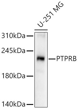 PTPRB Rabbit Polyclonal Antibody