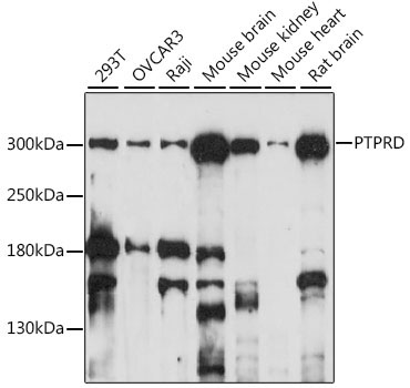 PTPRD Rabbit Polyclonal Antibody