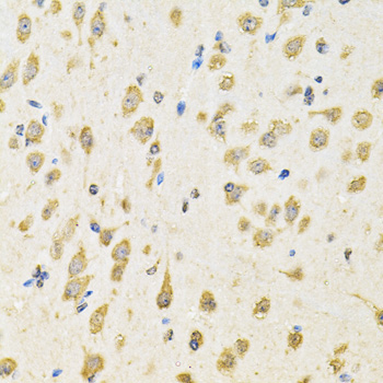 PTPRE Rabbit Polyclonal Antibody - Image 3