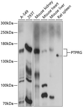 PTPRG Rabbit Polyclonal Antibody