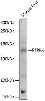 PTPRK Rabbit Polyclonal Antibody