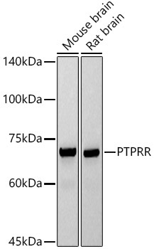 PTPRR Rabbit Monoclonal Antibody