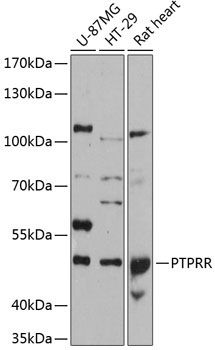 PTPRR Rabbit Polyclonal Antibody