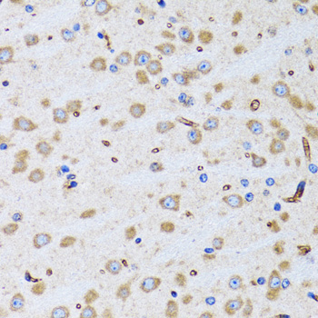 PTRH2 Rabbit Polyclonal Antibody - Image 2