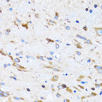 PTRH2 Rabbit Polyclonal Antibody - Image 3