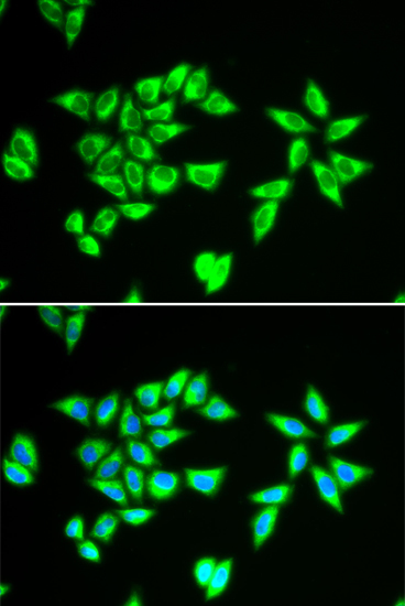 PTRH2 Rabbit Polyclonal Antibody - Image 4