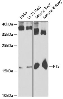 PTS Rabbit Polyclonal Antibody