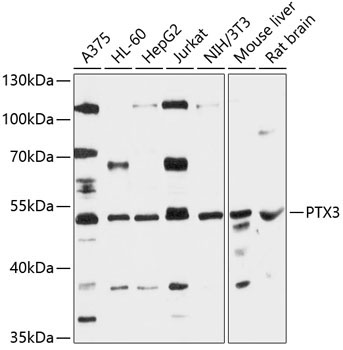 PTX3 Rabbit Polyclonal Antibody