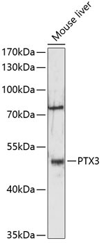 PTX3 Rabbit Polyclonal Antibody