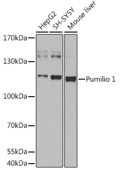 Pumilio 1 Rabbit Polyclonal Antibody