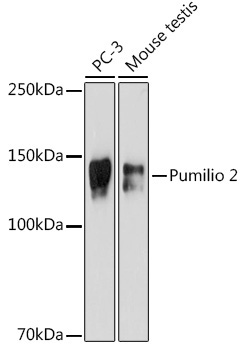 Pumilio 2 Rabbit Monoclonal Antibody - Image 2