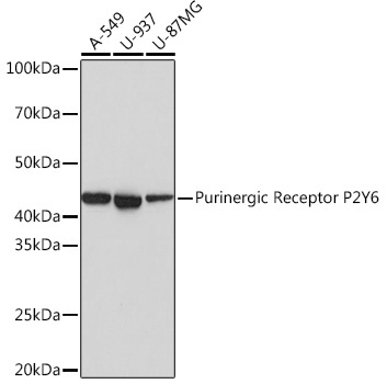 Purinergic Receptor P2Y6 Rabbit Monoclonal Antibody