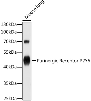 Purinergic Receptor P2Y6 Rabbit Polyclonal Antibody