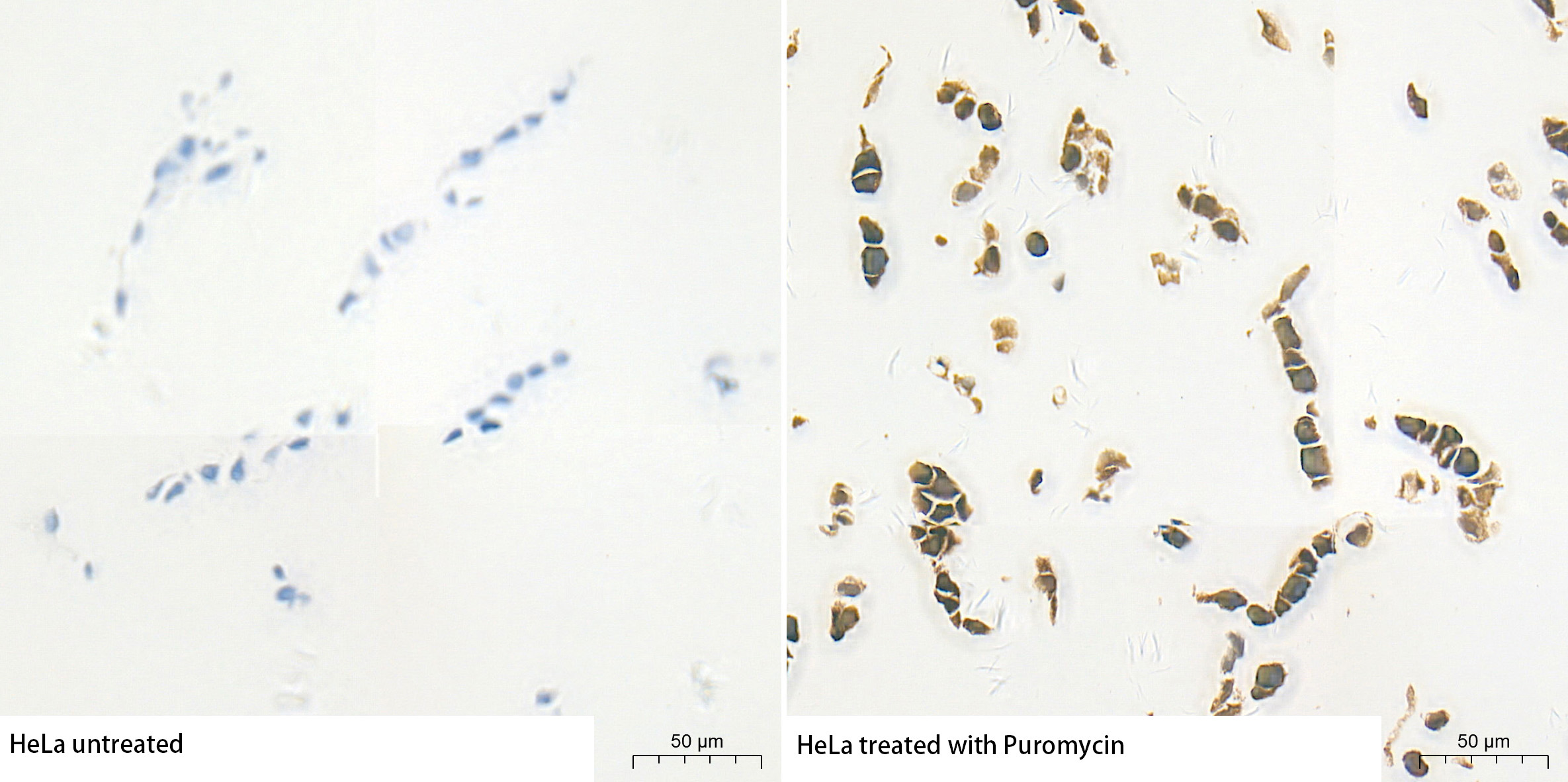 Puromycin Rabbit Polyclonal Antibody - Image 3