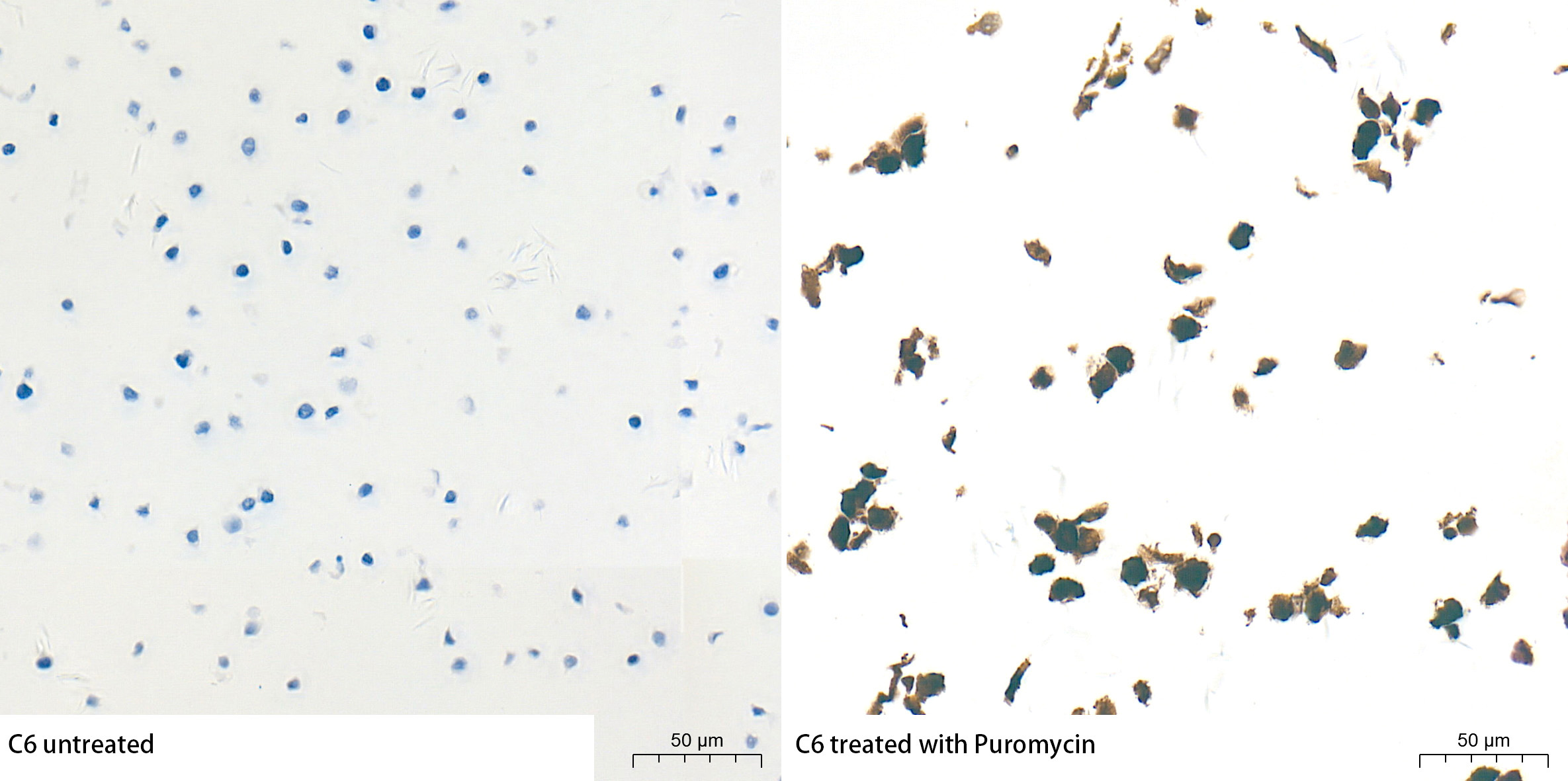Puromycin Rabbit Polyclonal Antibody - Image 4